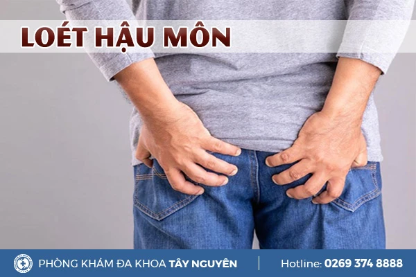 Phòng Khám Đa Khoa Tây Nguyên Gia Lai Pleiku - Chuyên Điều trị Bệnh trĩ