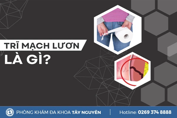 Phòng Khám Đa Khoa Tây Nguyên Gia Lai Pleiku - Chuyên Điều trị Bệnh trĩ
